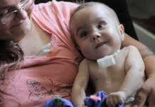 3D-шина спасла жизнь ребенку 3d принтер