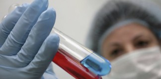 вакцина против ВИЧ