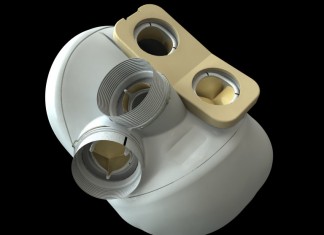 Имплантант сердца