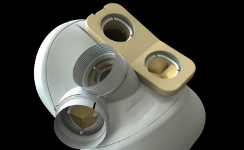 Имплантант сердца