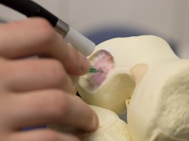 Хирургически сканер