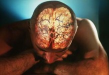 Дисплексия