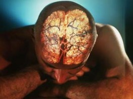 Дисплексия