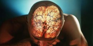 Дисплексия