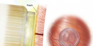 Медицинский супер клей