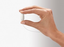 Великобритания использует Obalon для похудения (видео) Obalon