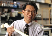 Остеоартрит