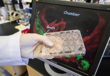 Человеческие клетки регенерируют сердце примата Стволовые клетки