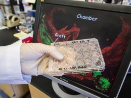 Стволовые клетки