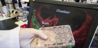 Стволовые клетки