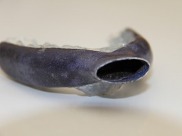 Способ избежать апноэ, во время сна, используя 3D технологии Капа 3D