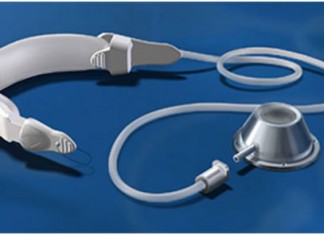 Основные достоинства операции бандажирования желудка