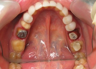 Здоровые зубы каждый день!