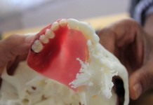 3D-печать помогает создавать верхнюю челюсть для больного раком челюсть 3D