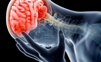 головная боль