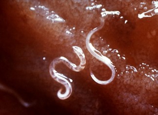 С глистами надо бороться!