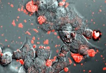 Крошечные клеточные пузыри обеспечивают подачу лекарств при болезни Паркинсона прямо в мозг parkinsons-bubbles