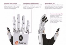 Британская женщина получает первую бионическую руку для женщин и подростков bebionic-small