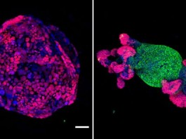 Оживление единственного гена превращает онкоклетки ободочной и прямой кишок вновь в нормальную ткань gene-reactivation