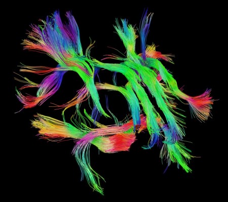 connectome-wiring-diagram-human-brain-6