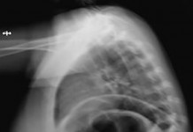 Вашингтонские ученые расширяют возможности xbox для получения качественной рентгеноскопии