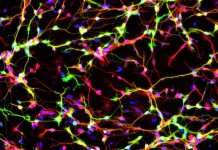 Ученые сумели создать функциональные нейроны на замену поврежденным