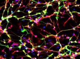 Ученые сумели создать функциональные нейроны на замену поврежденным Ученые сумели создать функциональные нейроны на замену поврежденным