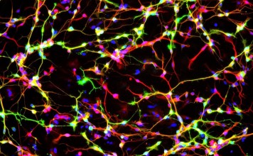 Ученые сумели создать функциональные нейроны на замену поврежденным