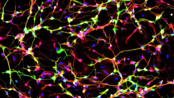Ученые сумели создать функциональные нейроны на замену поврежденным