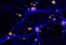 Обнаружен белок отвечающий за воспоминания