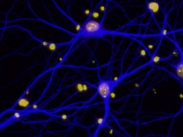 Обнаружен белок отвечающий за воспоминания