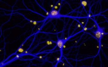 Обнаружен белок, отвечающий за воспоминания Обнаружен белок отвечающий за воспоминания