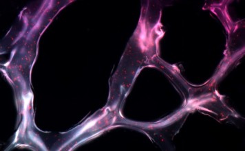 Ученые MIT создали гель борющийся с раком Ученые MIT создали гель борющийся с раком