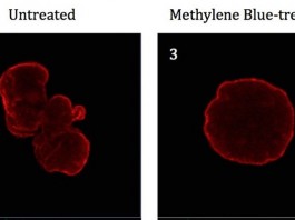 Ученые из Университета Мериленда нашли средство против старения Ученые из Университета Мериленда нашли средство против старения