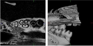 Ученые научились выращивать новые настоющие зубы
