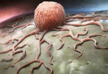 Австралийские ученые нашли безопасный способ лечения лейкоза