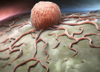 Австралийские ученые нашли безопасный способ лечения лейкоза