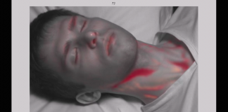 Ученые разработали измерительный прибор кровотока для ЧС