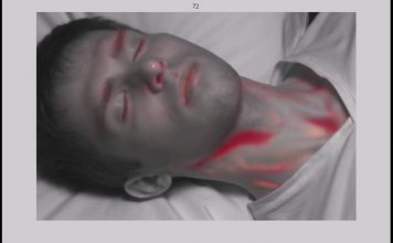 Ученые разработали измерительный прибор кровотока для ЧС Ученые разработали измерительный прибор кровотока для ЧС