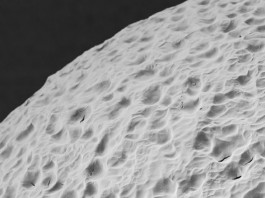 В обозримом будущем ученые победят сахарный диабет