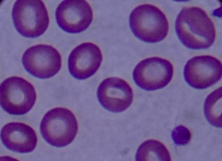 Ученые вновь маркируют рак