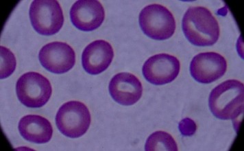 Ученые вновь маркируют рак