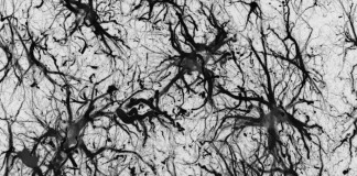 Доказано отсутствие связи между Альцгеймером и наследственностью