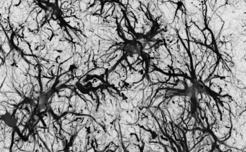 Доказано отсутствие связи между Альцгеймером и наследственностью