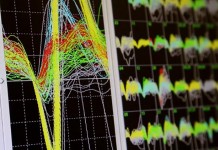 Ученые научились передавать управление коляской силе мысли