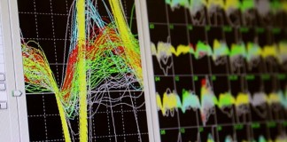 Ученые научились передавать управление коляской силе мысли