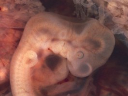 Ученые вновь ищут решение проблем в стволовых клетках