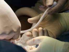 Ученые создали имплант сосудов не вызывающий отторжения
