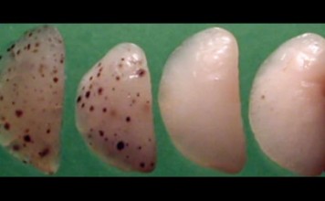 Ученые обнаружили клетки организма способные бороться с раком