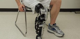 Ампутация ноги